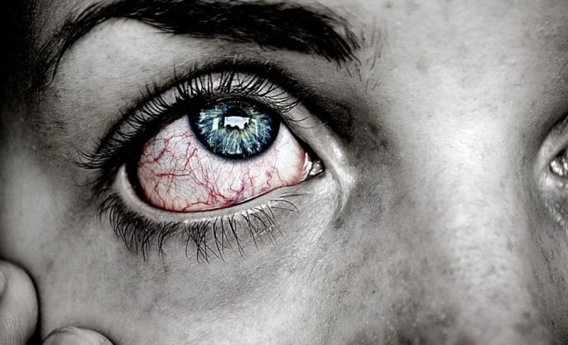 Kako pomagajo kapljice za oči pri suhih očeh